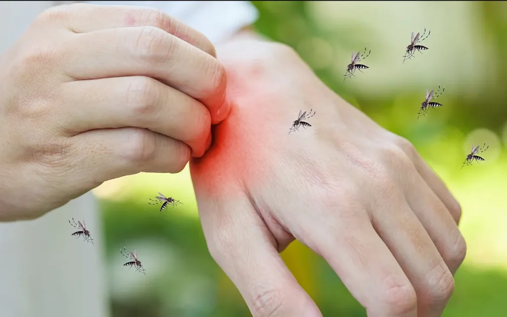 ciri ciri demam berdarah