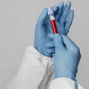 persiapan tes darah lengkap